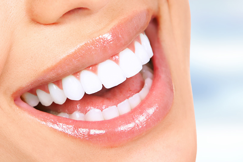 Cosmetic Dentistry in San Jose