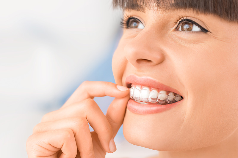 Orthodontics in San Jose